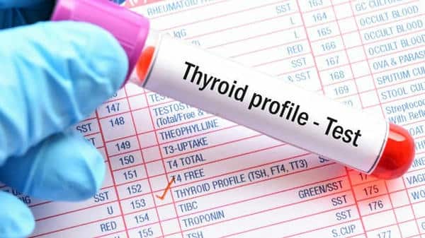 Thyroid Disorders: A Hidden Cause of Infertility