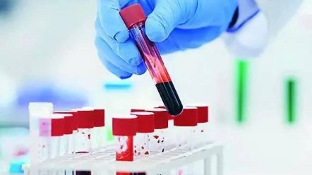 Blood Test Can Predict Lung Cancer Up to 5 Years Before Diagnosis