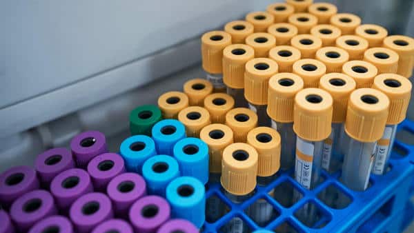 Blood Test for Lung Cancer Detection Shows Promise in Research