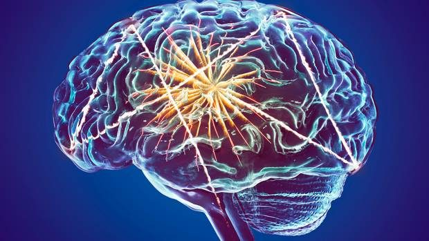 Addressing the Rising Dementia Crisis: Testing and Early Detection Challenges